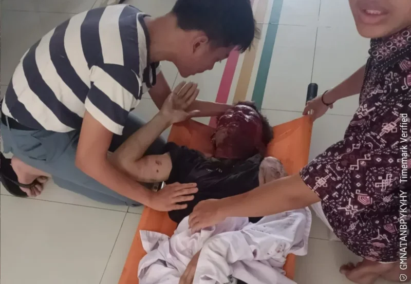 Korban luka berat dievakuasi warga ke rumah sakit terdekat. (Posnews)