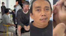 Anggota Buser Rentcar Nasional terluka usai diserang puluhan oknum ormas di Pasuruan Jawa Timur. (Posnews/MR)