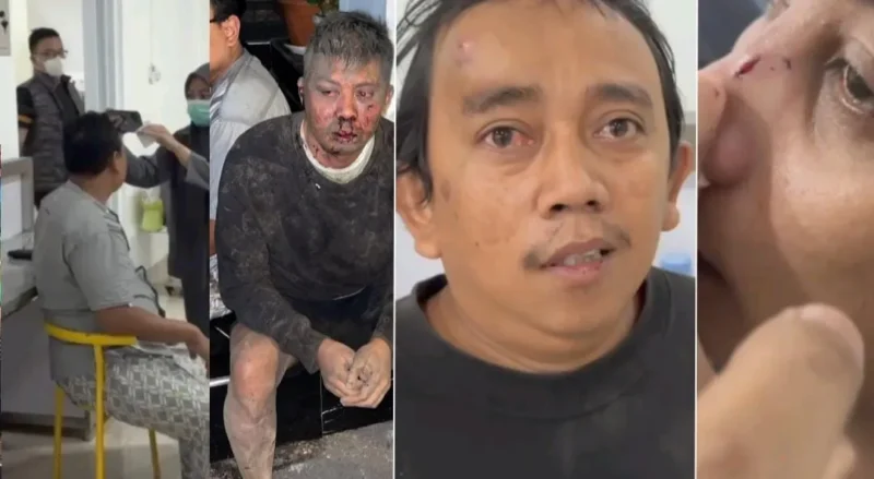 Anggota Buser Rentcar Nasional terluka usai diserang puluhan oknum ormas di Pasuruan Jawa Timur. (Posnews/MR)