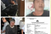 Anggota Buser Rentcar Nasional (BRN) Jawa Timur menunjukkan kondisi luka usai diduga dianiaya oknum Ormas Sakera di Sukorejo, Pasuruan. (Posnews/MR)