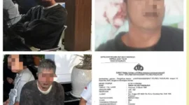 Anggota Buser Rentcar Nasional (BRN) Jawa Timur menunjukkan kondisi luka usai diduga dianiaya oknum Ormas Sakera di Sukorejo, Pasuruan. (Posnews/MR)
