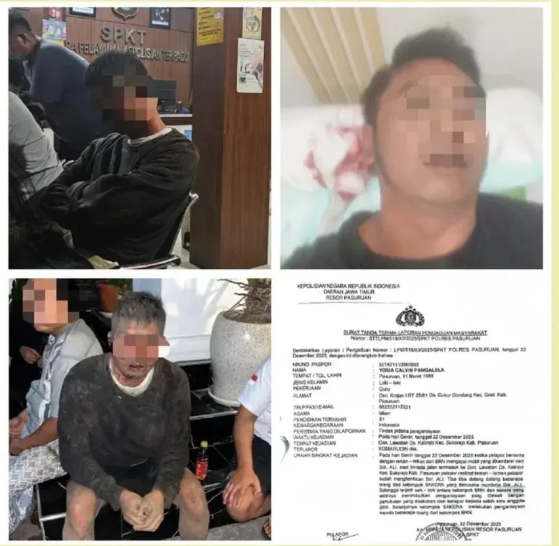 Anggota Buser Rentcar Nasional (BRN) Jawa Timur menunjukkan kondisi luka usai diduga dianiaya oknum Ormas Sakera di Sukorejo, Pasuruan. (Posnews/MR)