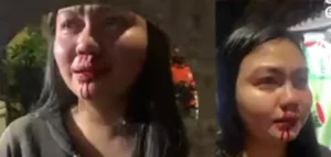 Pengendara Motor Aniaya Pasangan, Korban Dilarikan ke RS