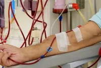 Pasien gagal ginjal menjalani proses cuci darah di rumah sakit akibat penonaktifan PBI BPJS Kesehatan. (Posnews/Net)