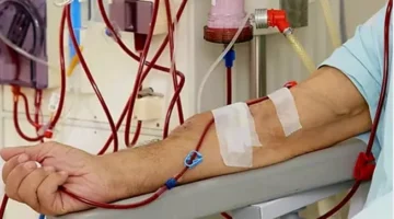 Pasien gagal ginjal menjalani proses cuci darah di rumah sakit akibat penonaktifan PBI BPJS Kesehatan. (Posnews/Net)