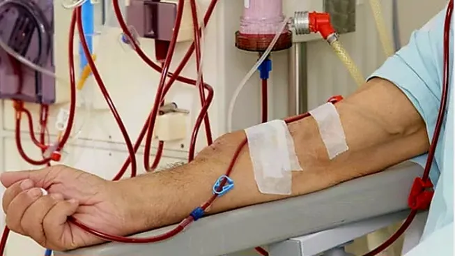 Pasien gagal ginjal menjalani proses cuci darah di rumah sakit akibat penonaktifan PBI BPJS Kesehatan. (Posnews/Net)