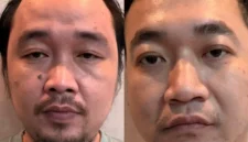 Petugas Bareskrim Polri mengamankan tersangka jaringan narkoba Ko Erwin di Apartemen Tokyo Riverside Jakarta. (Posnews/Ist)