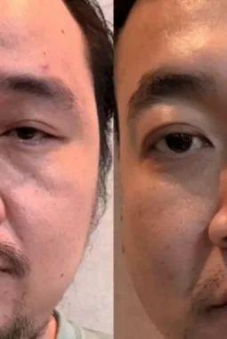 Bareskrim Polri Ringkus Penghubung dan Pemasok Sabu Jaringan Ko Erwin di Apartemen Mewah