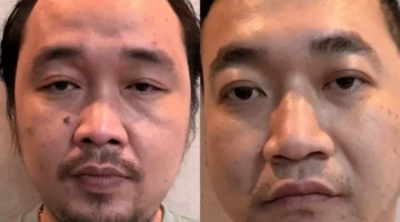 Petugas Bareskrim Polri mengamankan tersangka jaringan narkoba Ko Erwin di Apartemen Tokyo Riverside Jakarta. (Posnews/Ist)