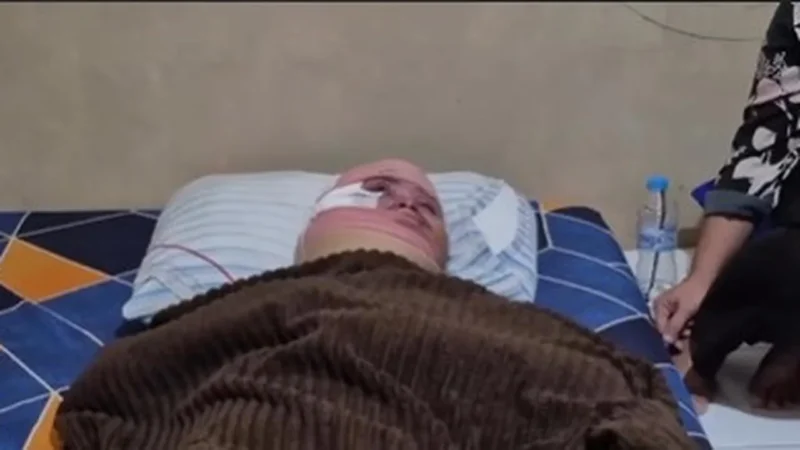 Korban mengalami luka permanen yang diduga tidak akan pulih seumur hidup. (Posnews/Instagram)