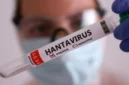 Ilustrasi, petugas kesehatan melakukan pemeriksaan terkait dugaan kasus hantavirus di Kulon Progo, Yogyakarta. (Posnews/Net)
