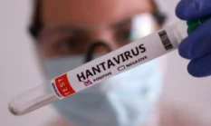 Suspek Hantavirus di Kulon Progo Negatif, DPR Minta Pengawasan Diperketat