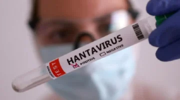 Ilustrasi, petugas kesehatan melakukan pemeriksaan terkait dugaan kasus hantavirus di Kulon Progo, Yogyakarta. (Posnews/Net)
