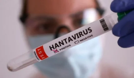Suspek Hantavirus di Kulon Progo Negatif, DPR Minta Pengawasan Diperketat