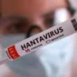 Ilustrasi, petugas kesehatan melakukan pemeriksaan terkait dugaan kasus hantavirus di Kulon Progo, Yogyakarta. (Posnews/Net)
