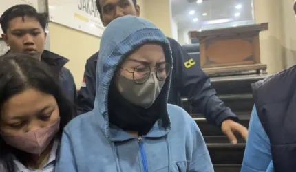 Model Cantik Ansy Jan De Vries Ngaku Dibegal, Ternyata Luka Bisul Pecah
