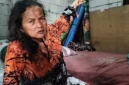Hendak ke Pasar, Nenek Rohani di Tarumajaya Diserang Monyet hingga Berdarah. (Net)
