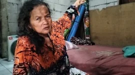 Hendak ke Pasar, Nenek Rohani di Tarumajaya Diserang Monyet hingga Berdarah. (Net)
